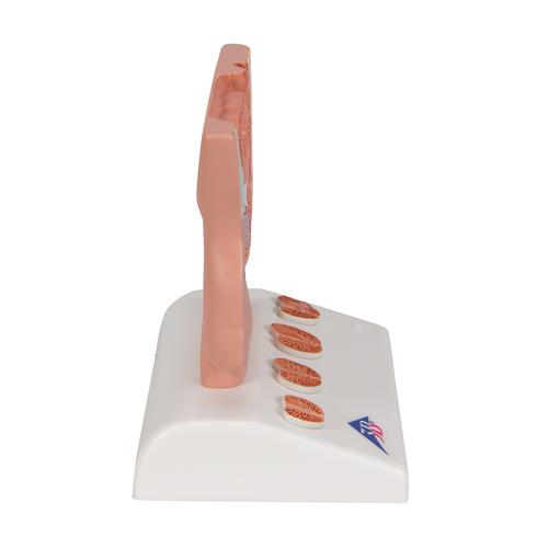 Prostate Model, 1/2 Natural Size, 1000319 [K41], Urology Models