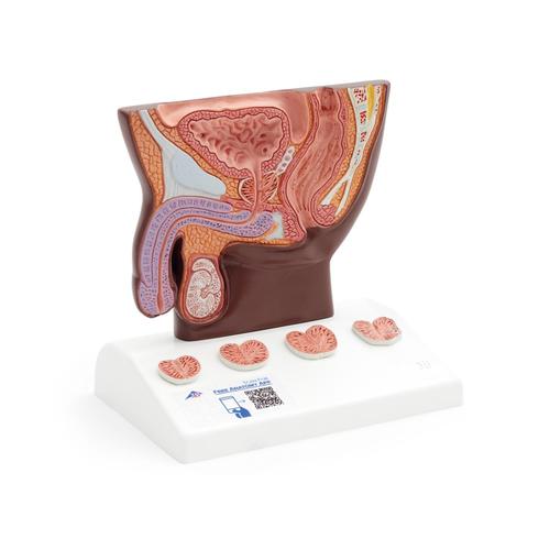 Modèle de prostate, échelle 1/2, peau foncée - 3B Smart Anatomy, 1024384 [K41D], Education à la santé Homme