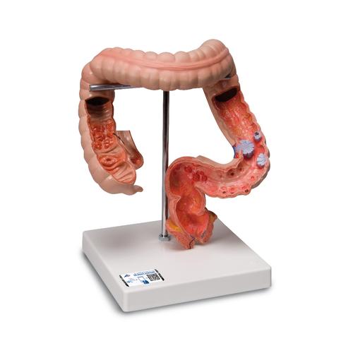 Pathologies de l'intestin, 1008496 [K55], Modèles de systèmes digestifs