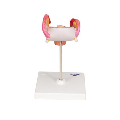 2개월의 태아 모형 Embryo Model, 2nd Month, 1000323 [L10/2], 임신 모형