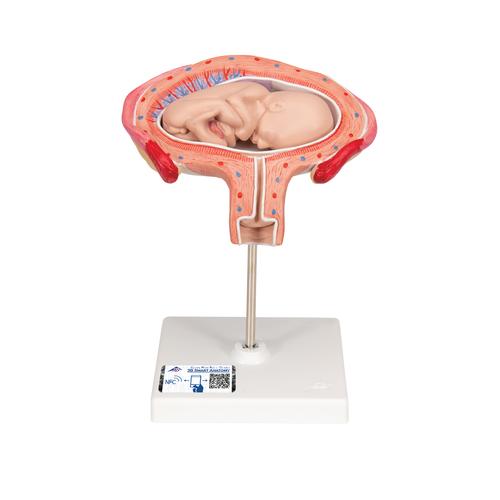 Fetus Model, 4th Month in Abdominal Position, 1018626 [L10/4], Human