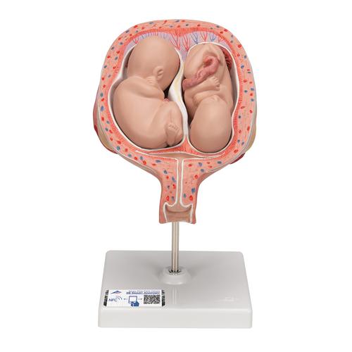 Twin Fetuses Model, 5th Month in Normal Position, 1000328 [L10/7], Human