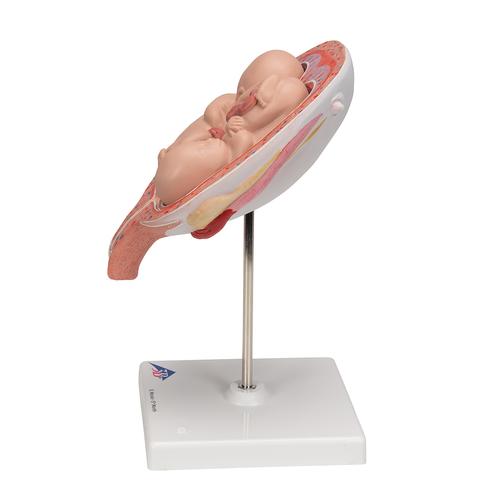 Twin Fetuses Model, 5th Month in Normal Position, 1000328 [L10/7], Pregnancy Models