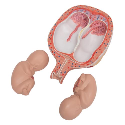 Twin Fetuses Model, 5th Month in Normal Position, 1000328 [L10/7], Pregnancy Models