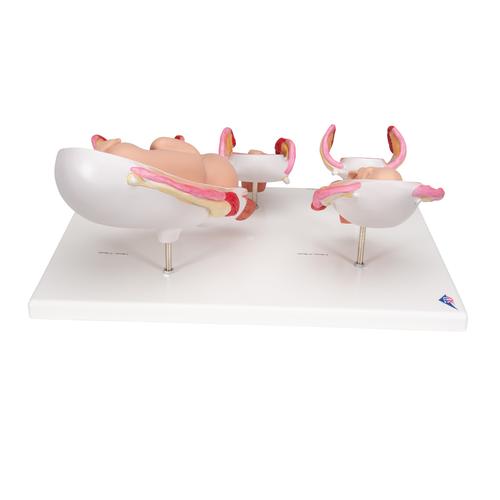 Pregnancy Models Series, 5 Embryo & Fetus Models on a Base, 1018633 [L11/9], Pregnancy Models