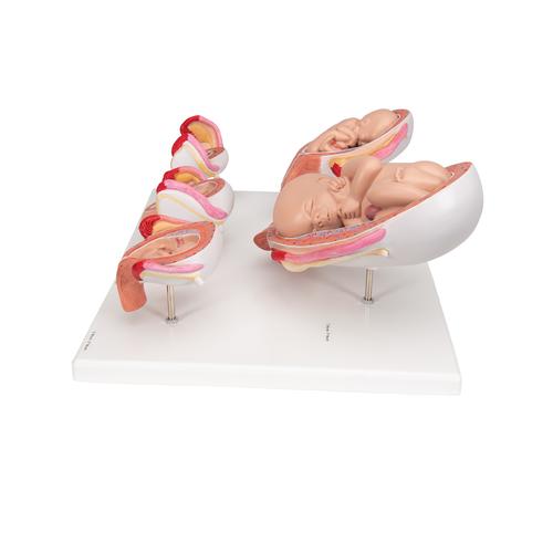 Pregnancy Models Series, 5 Embryo & Fetus Models on a Base, 1018633 [L11/9], Human