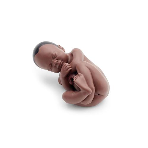 Pregnancy Pelvis Model in Median Section with Removable Fetus (40 weeks), 3 part, dark skin - 3B Smart Anatomy, 1024385 [L20D], Pregnancy Models