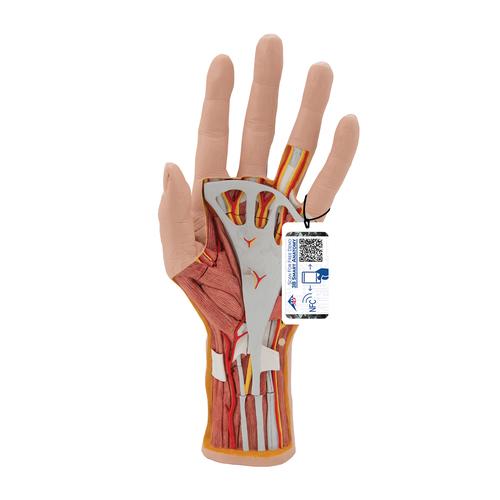 Life-Size Hand Model with Muscles, Tendons, Ligaments, Nerves & Arteries, 3 part, 1000349 [M18], Arm and Hand Skeleton Models