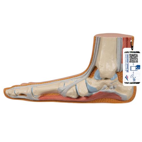 평발 Flat Foot (Pes Planus) Model, 1000355 [M31], 관절 모형