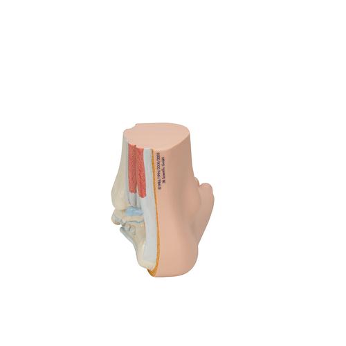 Flat Foot (Pes Planus) Model, 1000355 [M31], Joint Models