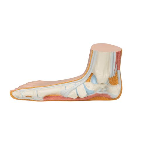 Flat Foot (Pes Planus) Model, 1000355 [M31], Joint Models