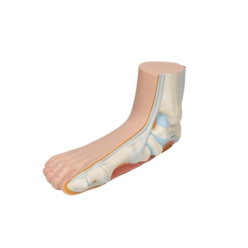 Flat Foot (Pes Planus) Model, 1000355 [M31], Joint Models