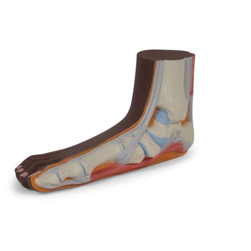 평발 Flat Foot (Pes Planus) Model, dark skin - 3B Smart Anatomy, 1024388 [M31D], 관절 모형