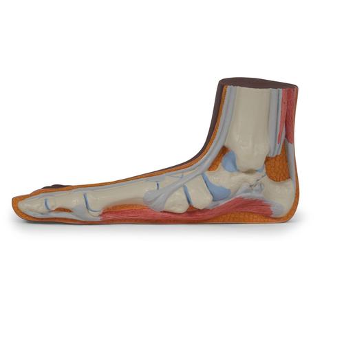 Flat Foot (Pes Planus) Model, dark skin, 1024388 [M31D], Joint Models