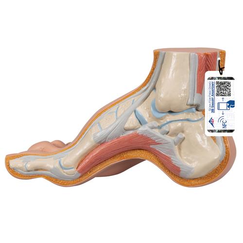 Hollow Foot (Pes Cavus) Model, 1000356 [M32], Joint Models