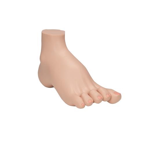 오목발(요족) Hollow Foot (Pes Cavus) Model, 1000356 [M32], 관절 모형