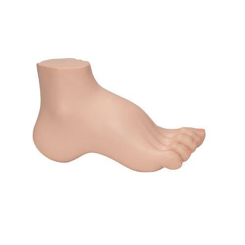 오목발(요족) Hollow Foot (Pes Cavus) Model, 1000356 [M32], 관절 모형