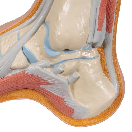 Hollow Foot (Pes Cavus) Model, 1000356 [M32], Joint Models