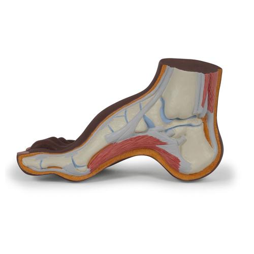 Fußmodell Hohlfuß (Pes cavus), dunkle Hautfarbe - 3B Smart Anatomy, 1024389 [M32D], Gelenkmodelle