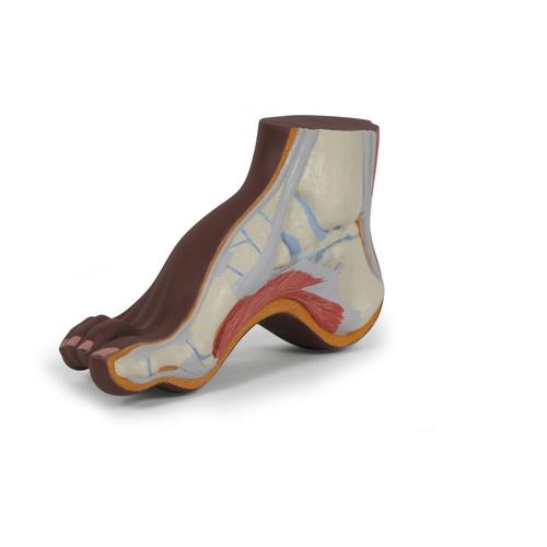 Hollow Foot (Pes Cavus) Model, dark skin - 3B Smart Anatomy, 1024389 [M32D], Joint Models