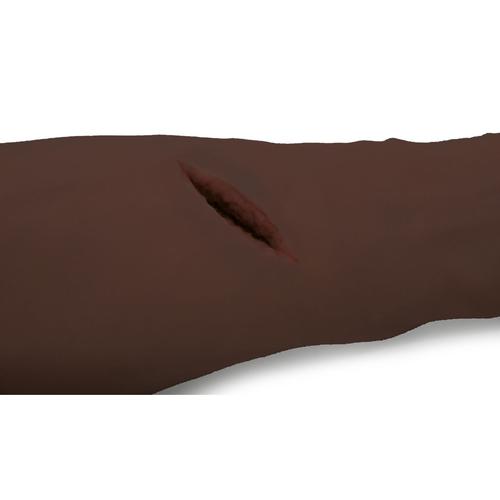 Brazo de entrenamiento de control de hemorragias P102D, tono de piel oscuro, 1023313 [P102D], Reanimación cardiopulmonar avanzada con traumatismo (ATLS)