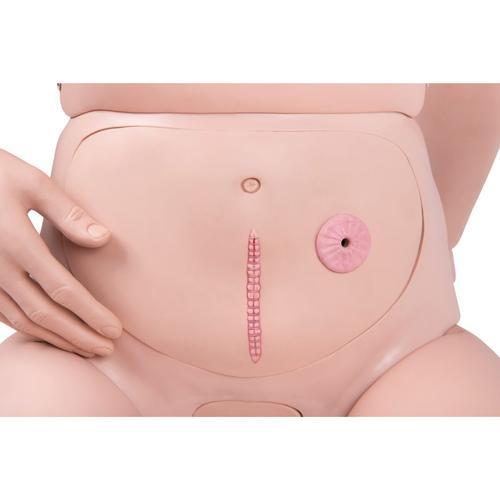 3B Scientific® Patient Care Manikin PRO, Light Skin, 1025295 [P10N], Ostomy Care