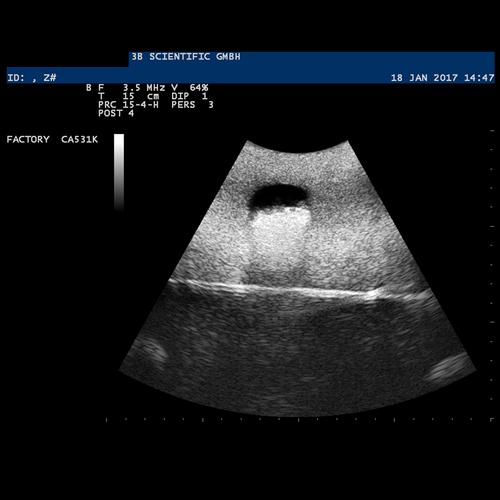 SONOtrain Ultrason Damar Modeli, 1019637 [P120], Ultrasound Skill Trainers