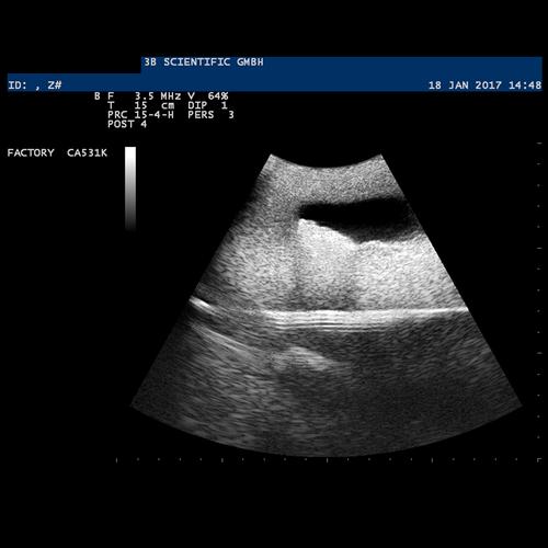 SONOtrain Ultrason Damar Modeli, 1019637 [P120], Ultrasound Skill Trainers