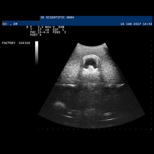 SONOtrain Ultrason Damar Modeli, 1019637 [P120], Ultrasound Skill Trainers