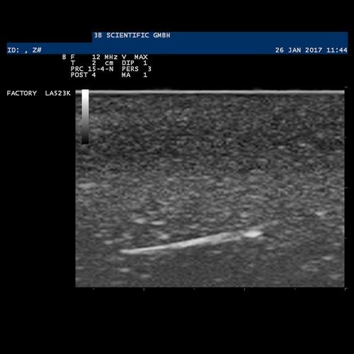 SONOtrain Foreign Body Model, Light Skin, 1019636 [P121], Ultrasound Skill Trainers