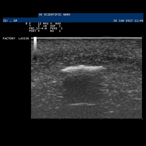 SONOtrain Foreign Body Model, Light Skin, 1019636 [P121], Ultrasound Skill Trainers