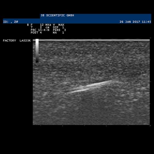 SONOtrain Foreign Body Model, Light Skin, 1019636 [P121], Ultrasound Skill Trainers