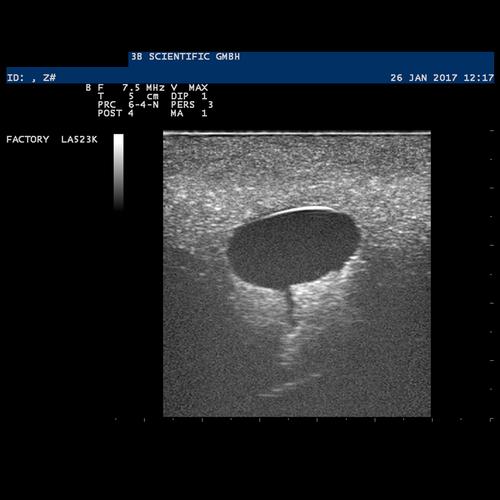 SONOtrain Kistli Meme Modeli, 1019634 [P124], Ultrasound Skill Trainers