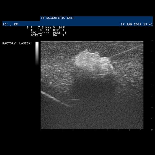 SONOtrain Modelo de tórax com cistos / Simulador para Treinamento de punção e aspiração de Mama Guiada por Ultrasom pele escura, 1024722 [P124D], Ultrasound Skill Trainers