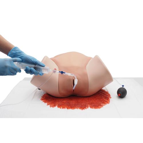 Postpartum Hemorrhage Simulator – PPH Trainer P97 PRO, Light Skin, 1023727 [P97P], Obstetrics