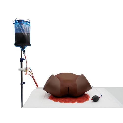 Postpartum Hemorrhage Simulator – PPH Trainer P97D PRO, Dark Skin, 1023975 [P97PD], Obstetrics