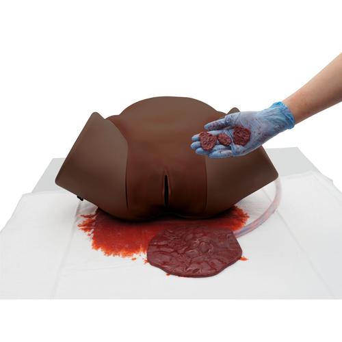 Postpartum Hemorrhage Simulator – PPH Trainer P97D PRO, Dark Skin, 1023975 [P97PD], Obstetrics