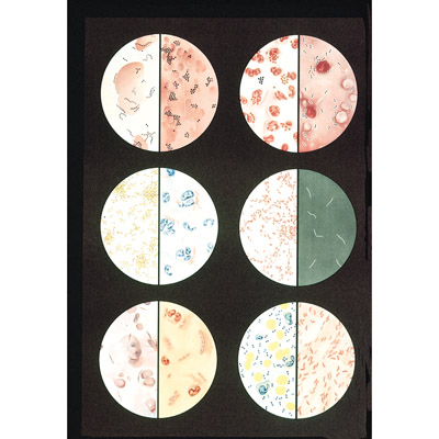 Bacteria Chart, 1001194 [V2041M], Parasitic, Viral or Bacterial Infection