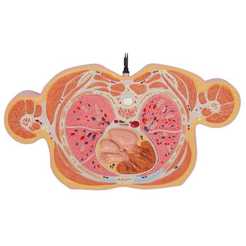 MRI 횡단면 상반신 모형 MRI Torso Model with 15 Transverse Sections, 1001237 [VA20], 인체 상반신 모형