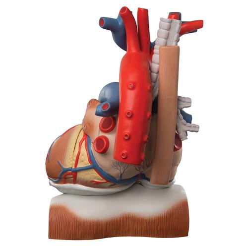 횡경막 위에 거치된 심장모형, 실제크기3배, 10-파트 Heart on Diaphragm, 3 times life size, 10 part, 1008547 [VD251], 심장 및 순환기 모형