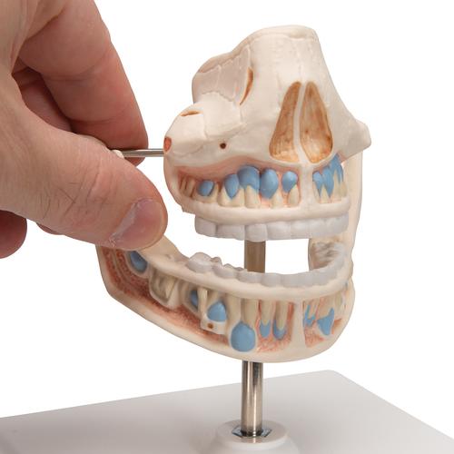 Dentadura de leche, 1001248 [VE282], Modelos dentales