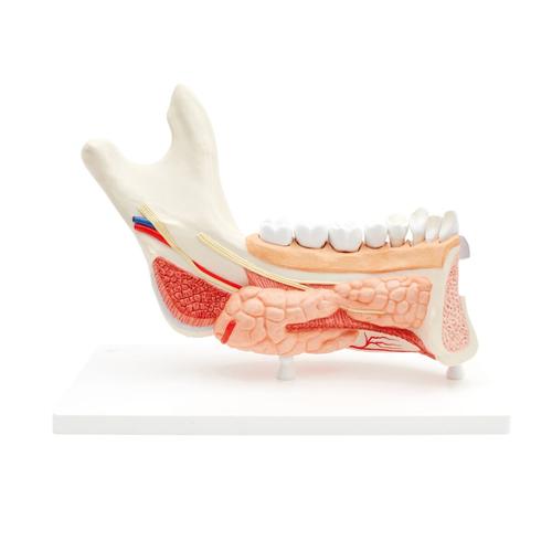 Comprehensive Lower Jaw Model (Left Half) with Diseased Teeth, Nerves, Vessels & Glands, 19 part, 1001250 [VE290], Dental Models