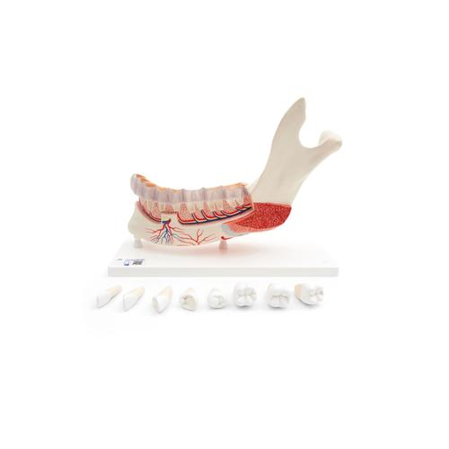 Comprehensive Lower Jaw Model (Left Half) with Diseased Teeth, Nerves, Vessels & Glands, 19 part, 1001250 [VE290], Dental Models