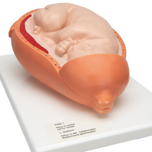 Birthing Process Model with 5 Stages, 1001258 [VG392], Pregnancy Models