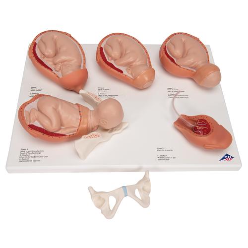 Labor Stages Model, Small, 1001259 [VG393], Pregnancy Models