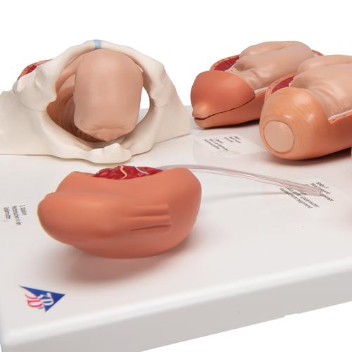 Labor Stages Model, Small, 1001259 [VG393], Pregnancy Models