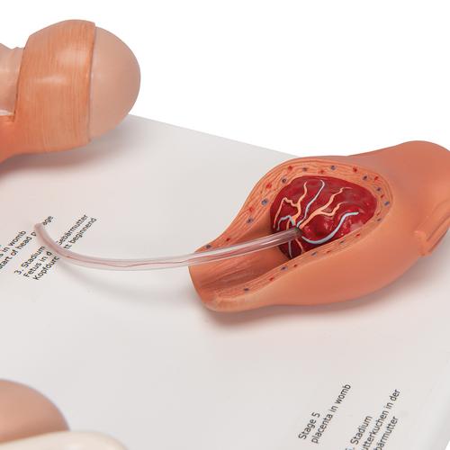 Geburtsstadien Modell, 1001259 [VG393], Schwangerschaft