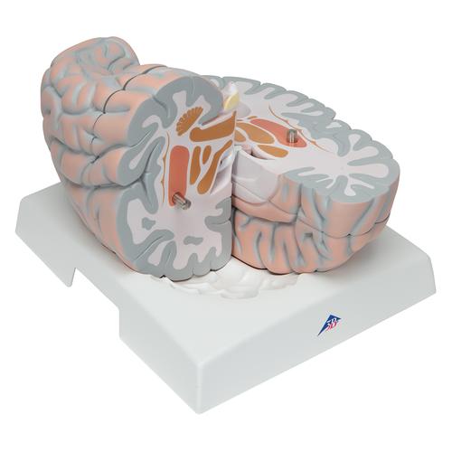 Гигантская модель мозга, 2.5-кратное увеличение, 14 частей - 3B Smart Anatomy, 1001261 [VH409], Модели мозга человека