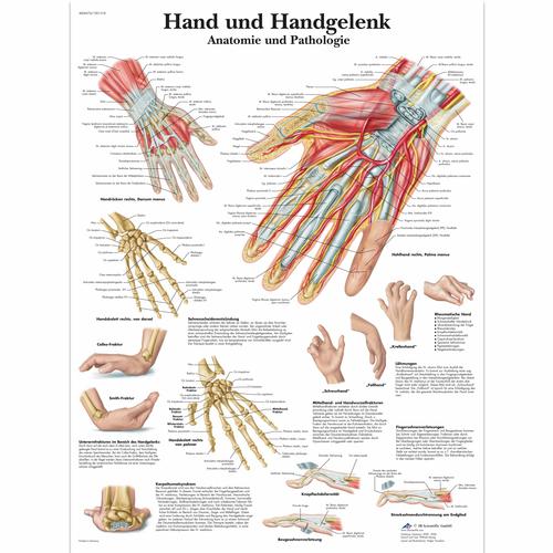 Hand und Handgelenk - Anatomie und Pathologie, 1001318 [VR0171L], 骨骼系统