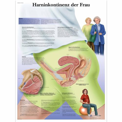 Harninkontinenz der Frau, 1001406 [VR0542L], Nőgyógyászat